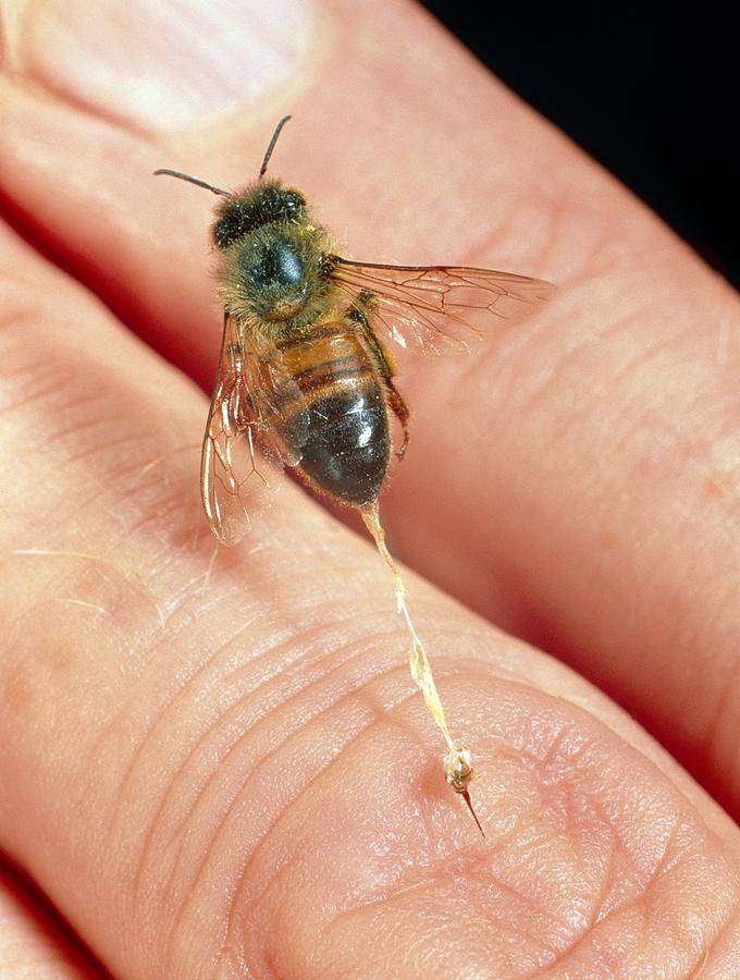 Если укусила пчела, оса, шершень, шмель как снять опухоль, оказать первую помощь - европейские рекомендации - университет здорового ребёнка няньковских