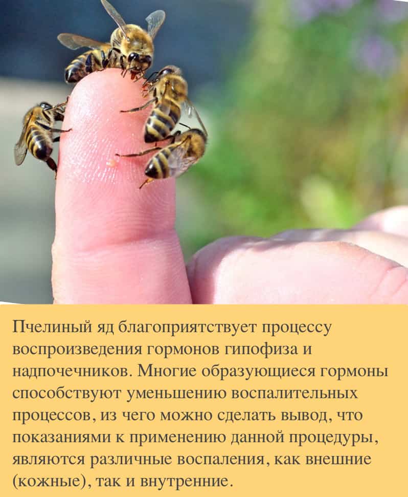 Укус пчелы: первая помощь при отёке