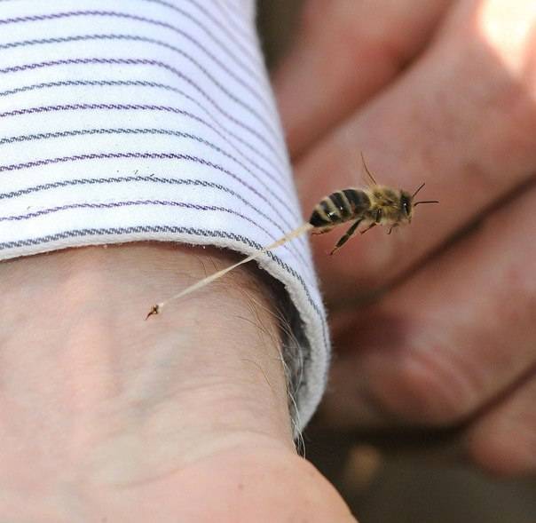 Что делать, если вас укусила оса или пчела, и первая помощь при укусах | энтеросгель